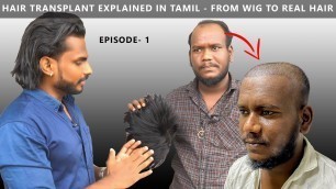 'what is Hair-Transplantation explained by a Doctor in Tamil | | Episode 1 | Men\'s Fashion Tamil'